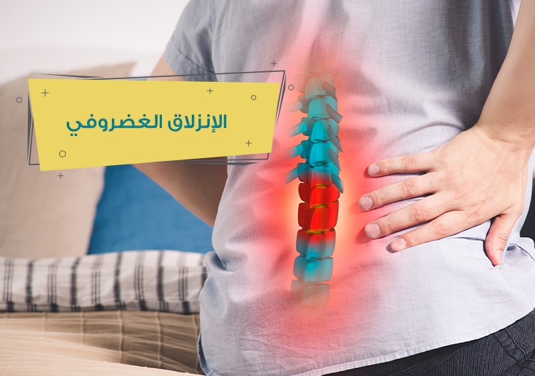 الإنزلاق الغضروفي - عيادات بيڤرلي