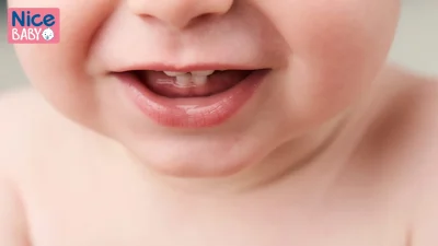 اعراض التسنين
